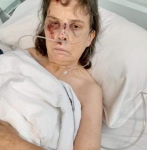 Police hunt two men over cowardly Melton kick