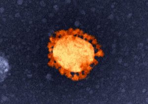 Covid worsens in west