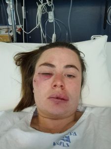 Jogger attacked on forest run